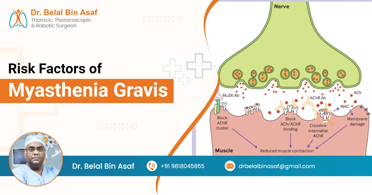Risk Factors of Myasthenia Gravis