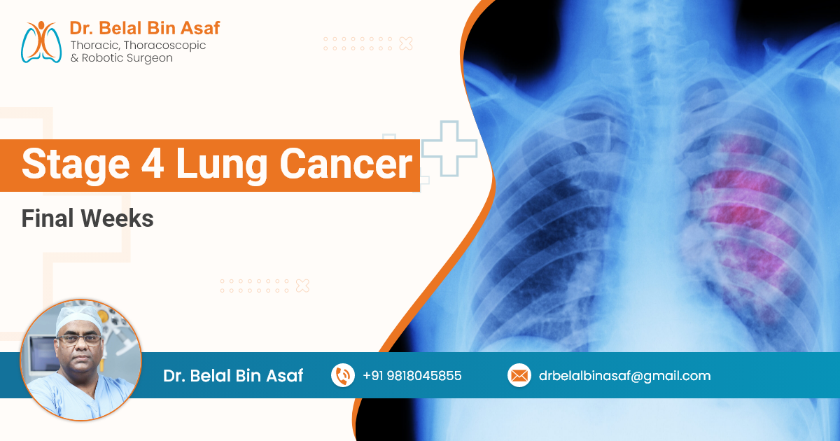 Stage 4 Lung Cancer Final Weeks