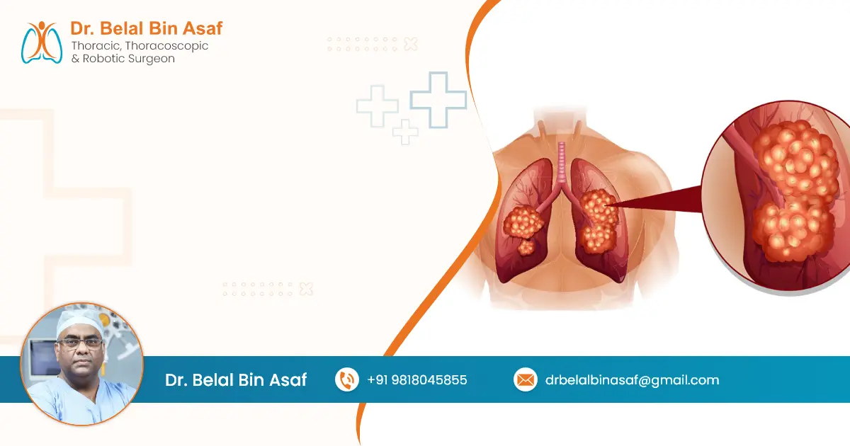Lung Nodule Size Chart Dr Belal Bin Asaf