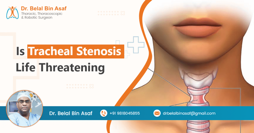 Lung Nodule Size Chart Dr Belal Bin Asaf