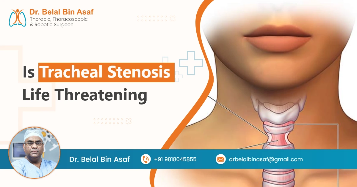 Is Tracheal Stenosis Life Threatening
