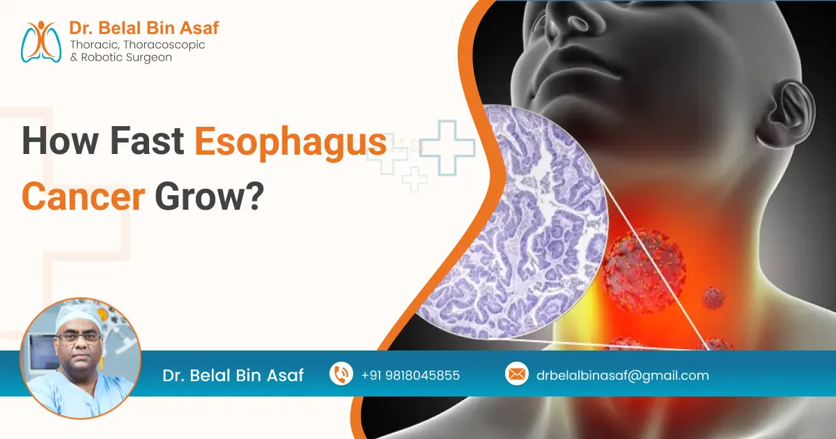 How Fast Esophagus Cancer Grow?