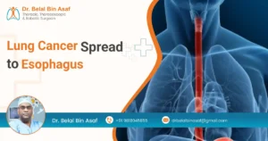 Lung Cancer Spread to Esophagus