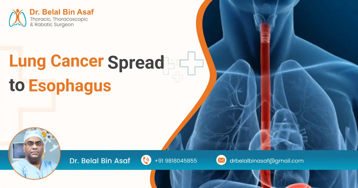 Lung Cancer Spread to Esophagus