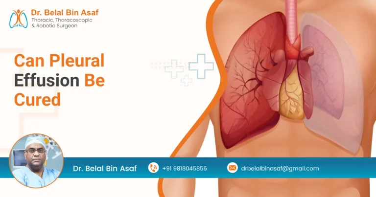 Can Pleural Effusion Be Cured?