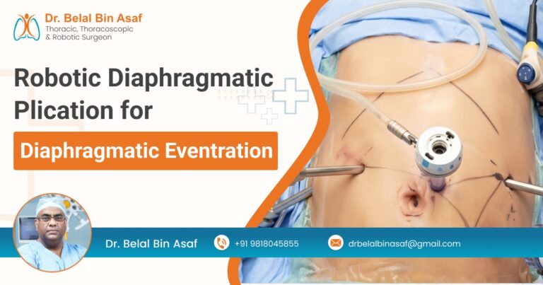 Robotic Diaphragmatic Plication for Eventration: A Retrospective Analysis of Efficacy, Safety, and Feasibility