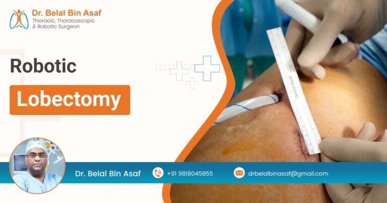 Robotic Lobectomy: The First Indian Report