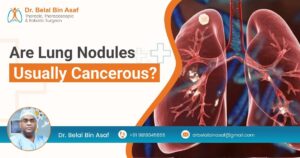 Are Lung Nodules Usually Cancerous?