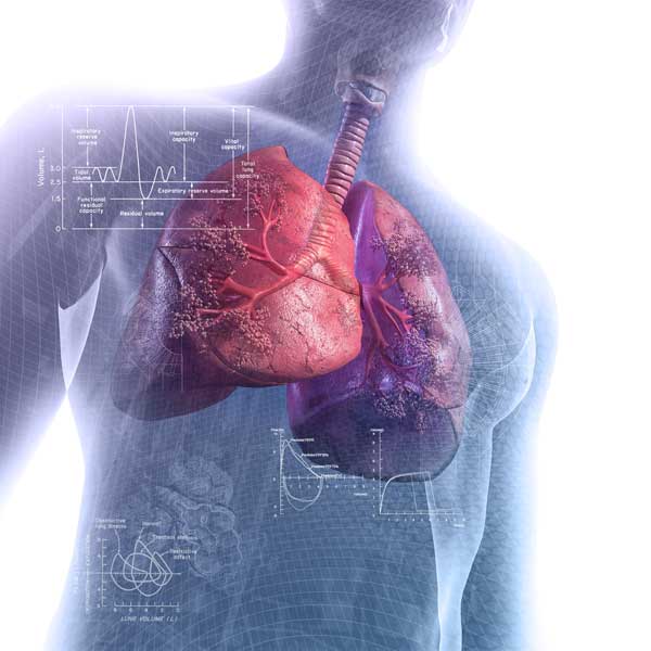 Best Doctor for Lung Cancer in Gurgaon