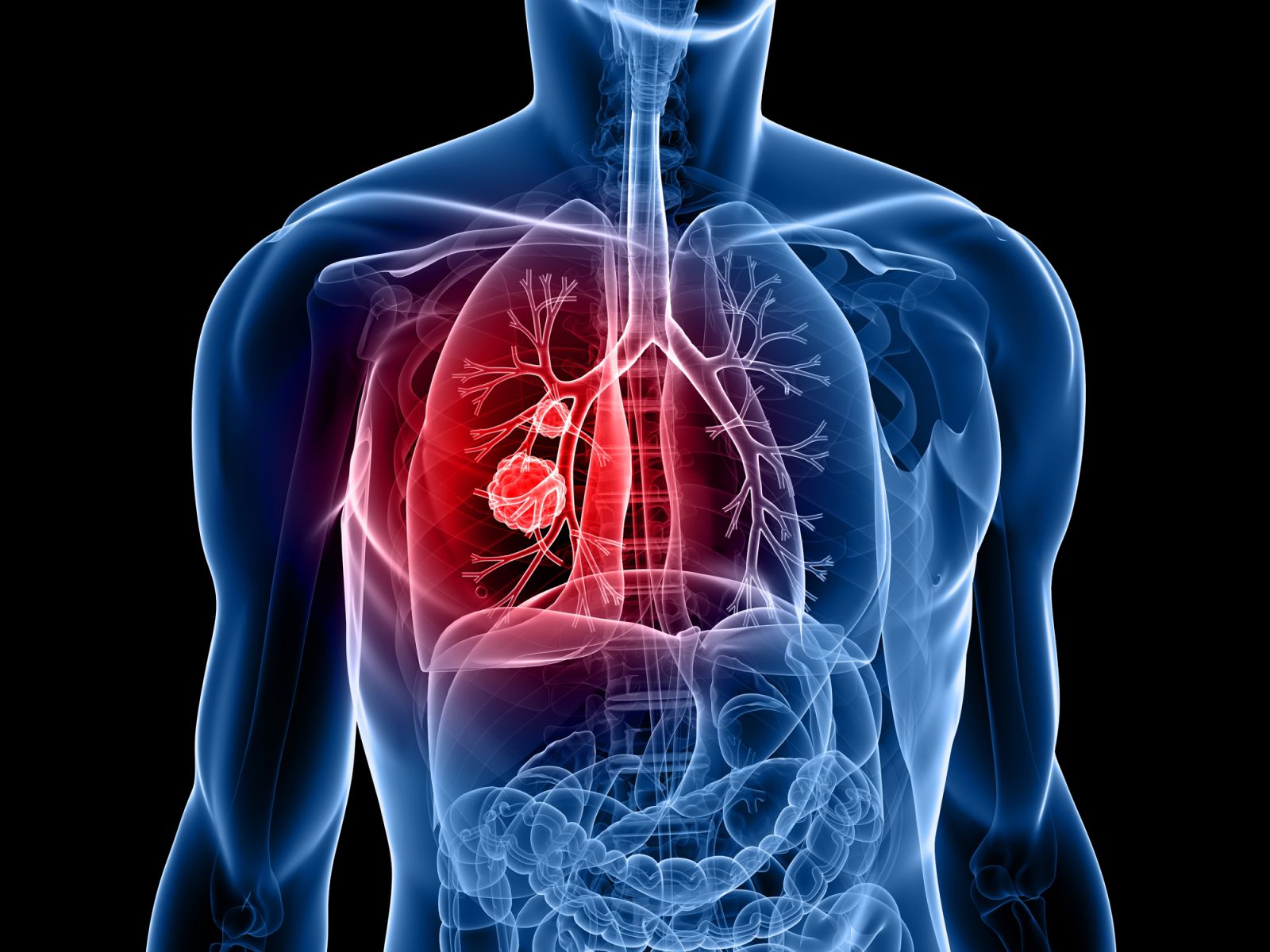 Lung Surgeon