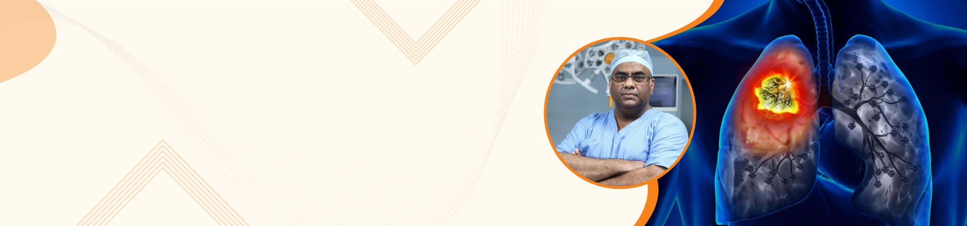 best lung cancer specialist in delhi