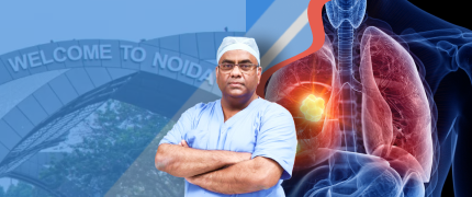 best lung cancer specialist in Noida   