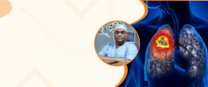 best lung cancer specialist in delhi