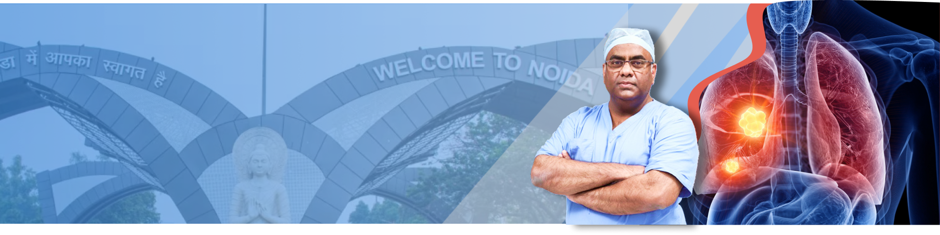 best lung cancer specialist in Noida