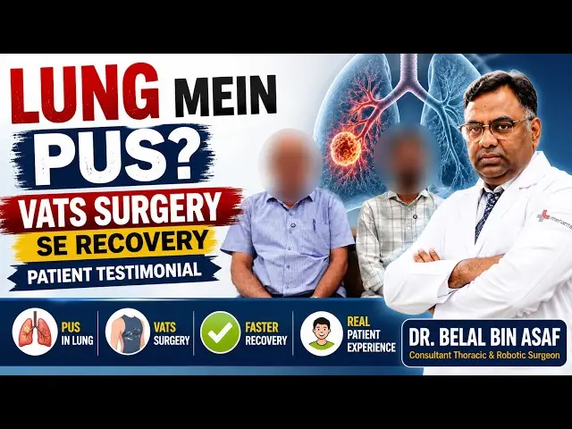 Video 3